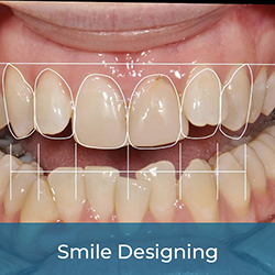 customized smile makeover treatments to boost your confidence.
